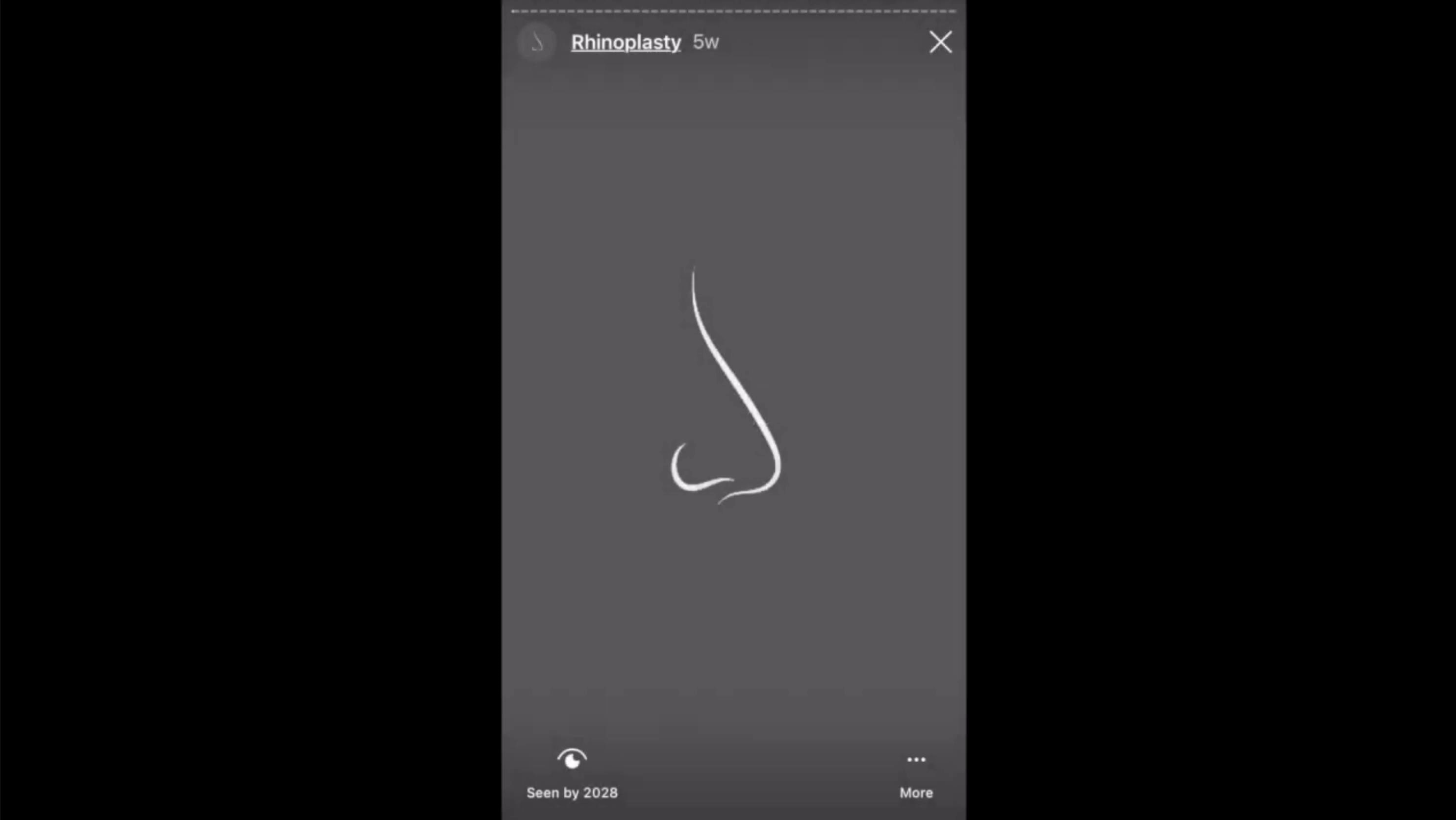 best rhinoplasty surgeons